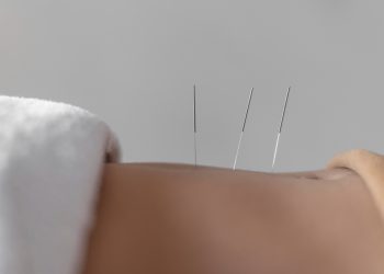 Combining Dry Needling and Physical Therapy for Optimal Pain Relief in Huntsville