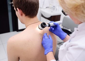 How to Identify Warts Close-Up: A Comprehensive Guide