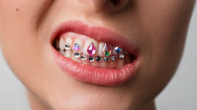 The Pros of Getting Tooth Gems: A Sparkling Trend in Dental Fashion