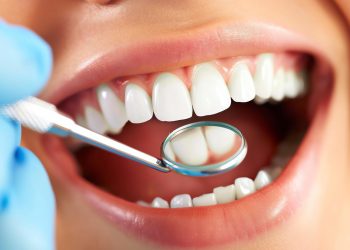 Achieve Your Perfect Smile with a Renton Cosmetic Dentist