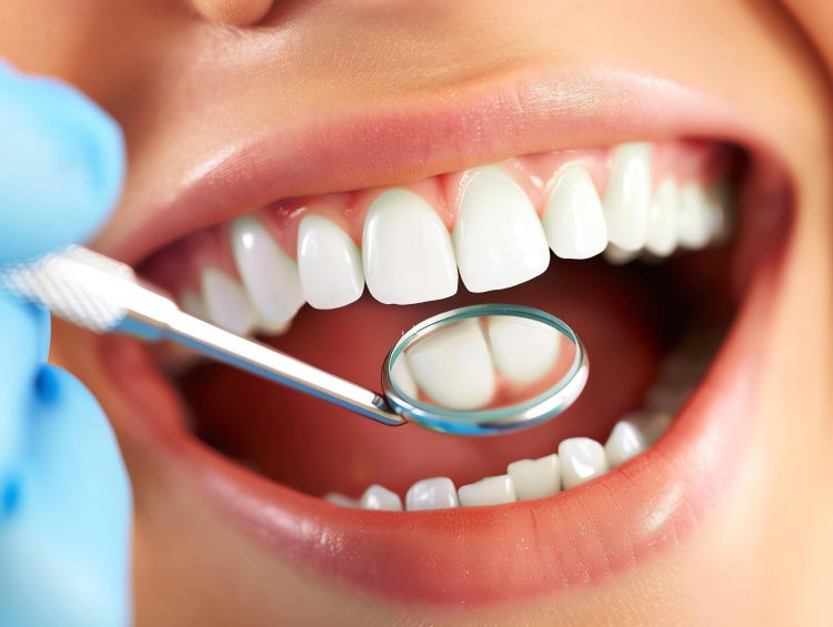 Achieve Your Perfect Smile with a Renton Cosmetic Dentist