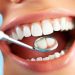 Achieve Your Perfect Smile with a Renton Cosmetic Dentist