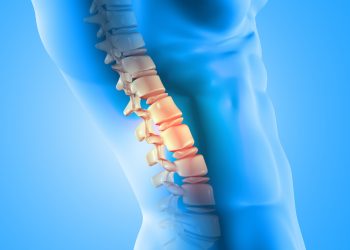 Is Spinal Decompression an Effective Alternative to Surgery?