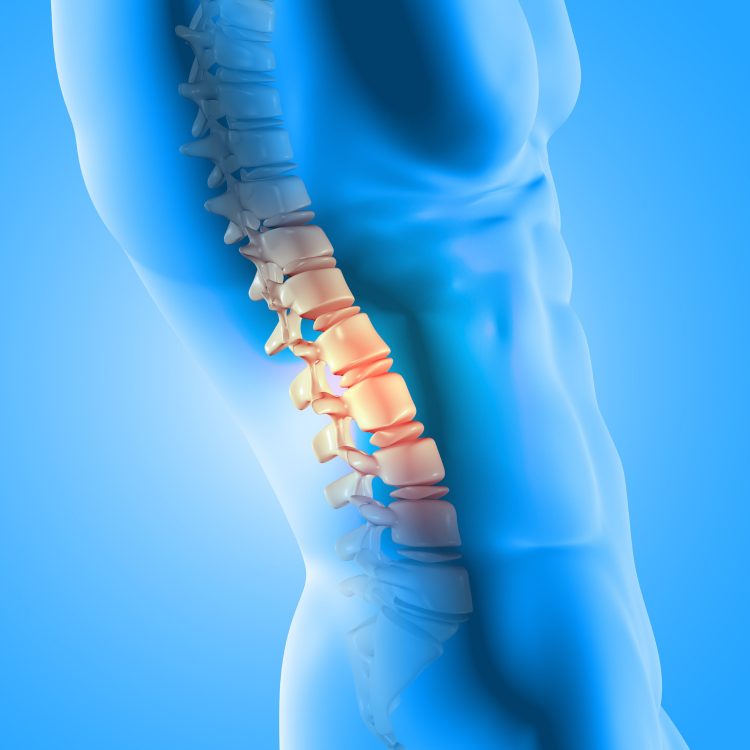 Is Spinal Decompression an Effective Alternative to Surgery?