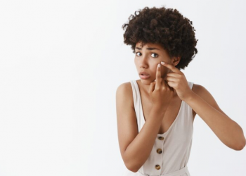 Acne and Scars: Why Some Marks Fade and Others Stay (and What Skin Actually Needs to Heal)